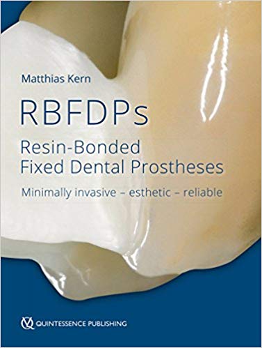 Resin-Bonded Fixed Dental Prostheses: Minimally invasive – esthetic – reliable-EPUB