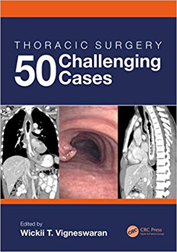Thoracic Surgery: 50 Challenging cases-Original PDF