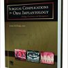 Surgical Complications in Oral Implantology: Etiology, Prevention, and Management-Original PDF