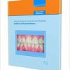 Indirect Restorations (Quintessentials of Dental Practice)-EPUB
