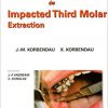 Clinical Success In Impacted Third Molar Extraction-EPUB