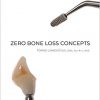 Zero Bone Loss Concepts-Original PDF