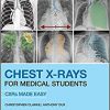 Chest X-Rays for Medical Students: CXRs Made Easy 2nd Edition-Original PDF