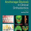 Temporary Anchorage Devices in Clinical Orthodontics-Original PDF