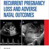 Recurrent Pregnancy Loss and Adverse Natal Outcomes-Original PDF