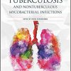 Tuberculosis and Nontuberculous Mycobacterial Infections (ASM Books) 7th Edition-EPUB