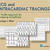 ECG and Intracardiac Tracings: A Toolkit Approach for Analyzing Arrhythmias-High Quality PDF