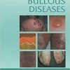 Atlas of Bullous Diseases-Original PDF