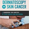 Dermatoscopy and Skin Cancer: A handbook for hunters of skin cancer and melanoma-Original PDF