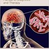 Tuberculous Meningitis: Manual of Diagnosis and Therapy-Original PDF