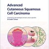 Fast Facts: Advanced Cutaneous Squamous Cell Carcinoma for Patients and their Supporters: Information + Taking Control = Best Outcome-Original PDF