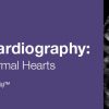2020 Fetal Echocardiography: Normal and Abnormal Hearts – A Video CME Teaching Activity