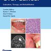 Oral Cancer: Evaluation, Therapy, and Rehabilitation-EPUB