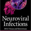 Neuroviral Infections: RNA Viruses and Retroviruses-Original PDF