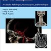 Incidental Findings in Neuroimaging and Their Management: A Guide for Radiologists, Neurosurgeons, and Neurologists-Original PDF