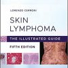 Skin Lymphoma: The Illustrated Guide 5th Edition-Original PDF
