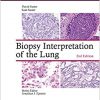 Biopsy Interpretation of the Lung (Biopsy Interpretation Series) 2nd Edition-EPUB