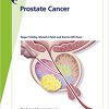 Fast Facts: Prostate Cancer: If, when and how to intervene 10th edition-Original PDF