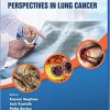 Perspectives in Lung Cancer (Frontiers in Lung Cancer Book 1)-Original PDF