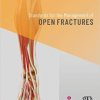 Standards for the Management of Open Fractures-PDF
