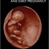 Ultrasound in Assisted Reproduction and Early Pregnancy-Original PDF