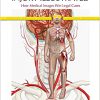 Injury Illustrated: How Medical Images Win Legal Cases-Original PDF