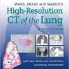 Webb, Müller and Naidich’s High-Resolution CT of the Lung Sixth Edition-EPUB+Converted PDF