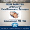 Facial Paralysis: Contemporary Facial Reanimation Techniques-Videos