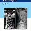 Instrumentation for Minimally Invasive Spine Surgery-Original PDF