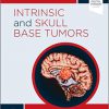 Intrinsic and Skull Base Tumors: Neurosurgery: Case Management Comparison Series-Original PDF