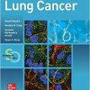 Lung Cancer: Standards of Care-High Quality PDF