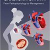 Peripartum Cardiomyopathy: From Pathophysiology to Management-Original PDF