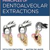 Principles of Dentoalveolar Extractions-Original PDF