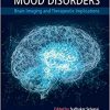 Mood Disorders: Brain Imaging and Therapeutic Implications-Original PDF