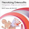 Necrotizing Enterocolitis: pathogenesis, diagnosis and treatment-Original PDF