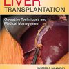 Liver Transplantation: Operative Techniques and Medical Management-High Quality PDF