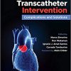 Aortic Valve Transcatheter Intervention: Complications and Solutions-Original PDF