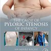 The Cause of Pyloric Stenosis of Infancy-Original PDF