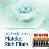 Understanding Platelet-Rich Fibrin-Original PDF