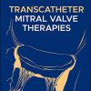 Transcatheter Mitral Valve Therapies-Original PDF