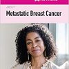 100 Questions & Answers About Metastatic Breast Cancer-EPUB
