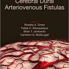 Cerebral Dural Arteriovenous Fistulas-Original PDF