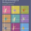Flow Cytometry of Hematological Malignancies 2nd Edition-True PDF
