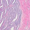 Gynecologic Pathology 2020-Videos+PDFs