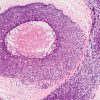 Breast Pathology 2020-Videos+PDFs
