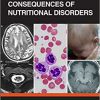 Neurological Consequences of Nutritional Disorders-Original PDF