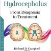 Hydrocephalus: From Diagnosis to Treatment-Original PDF