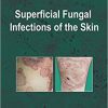 Superficial Fungal Infections of the Skin-Original PDF