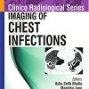 Clinico Radiological Series: Imaging of Chest Infections-Original PDF