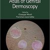 Atlas of Genital Dermoscopy (Series in Dermatological Treatment)-Original PDF